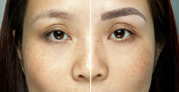 Before and after images of a woman with microblading treatment.